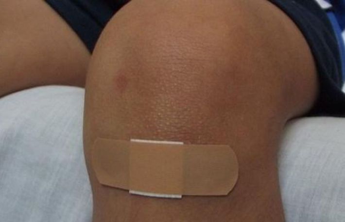 Cum sa cureti si sa cosi o rana deschisa?