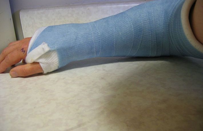 Cum se trateaza o incheietura luxata?