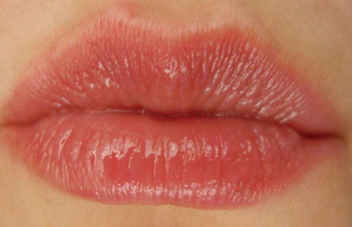 5 solutii eficiente pentru vindecarea buzelor umflate