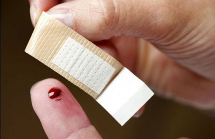 Cum sa scoti o aschie din deget