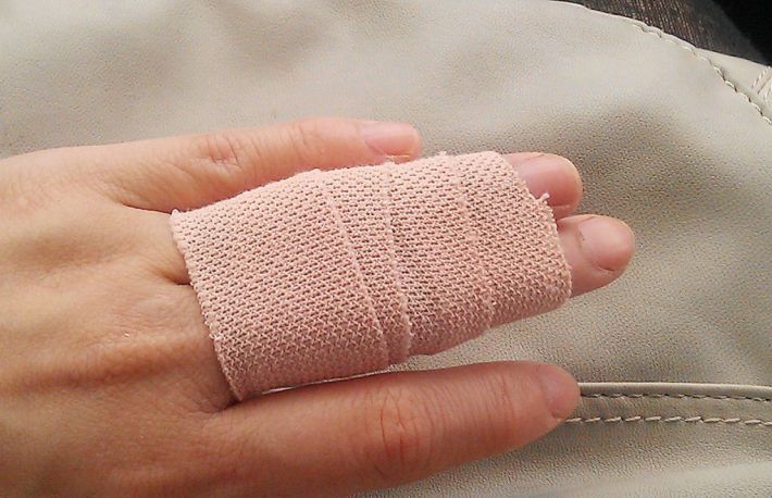 Cum sa infasori un deget rupt in leucoplast?