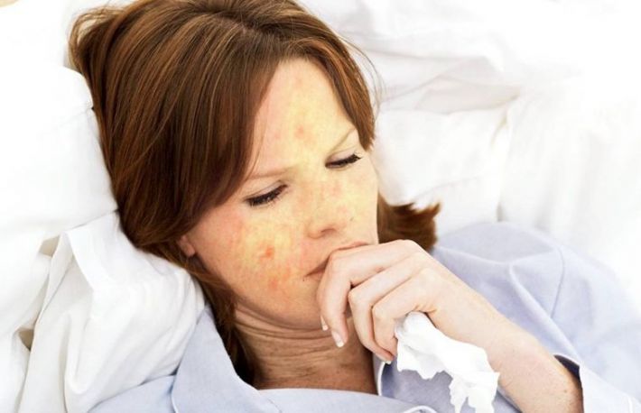 Cum se trateaza pojarul 