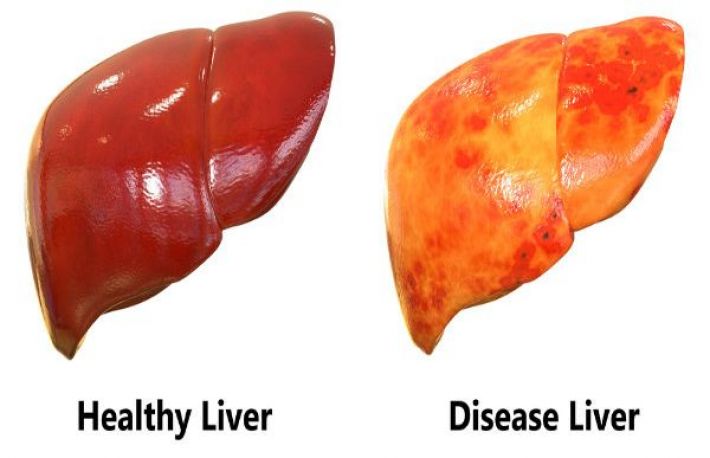 16 alimente care curata in mod natural ficatul 