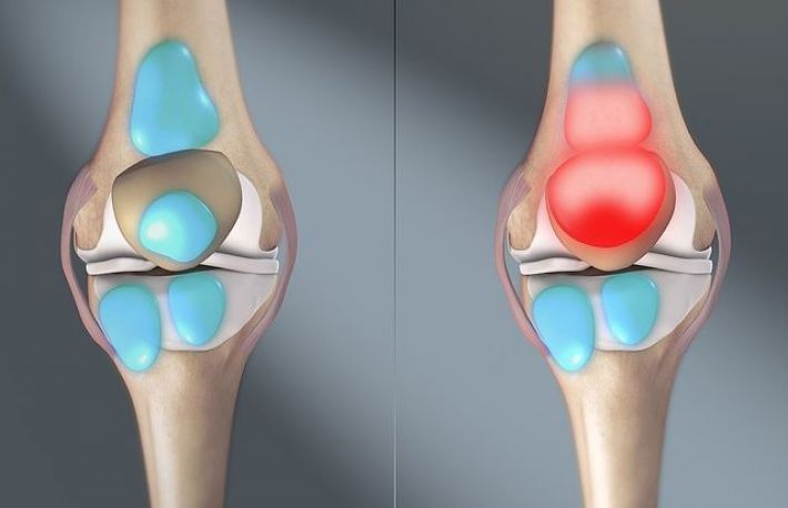 Cauzele durerilor articulare