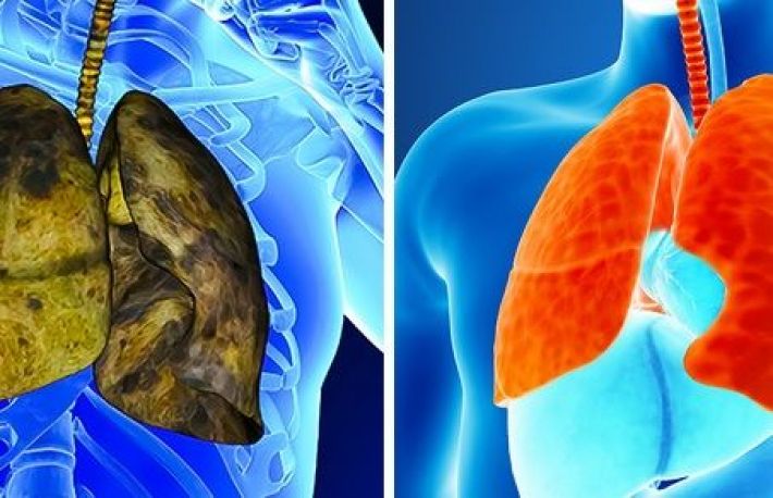 5 semne ca plamanii sunt bolnavi