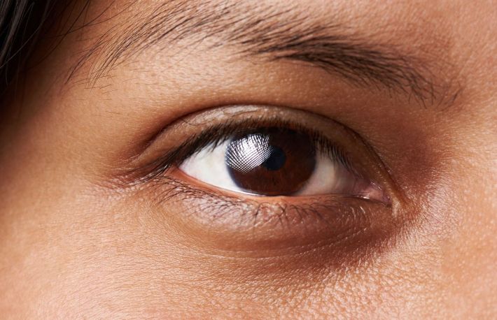 Cum sa scapi de cearcane. Reteta de casa