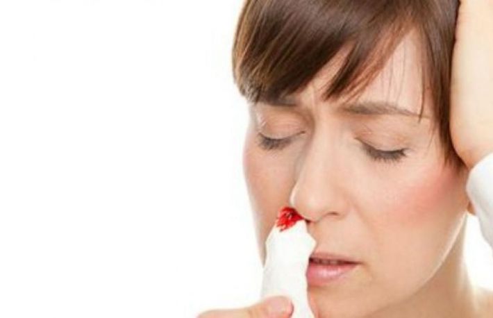 Cum sa tratezi o sangerare nazala