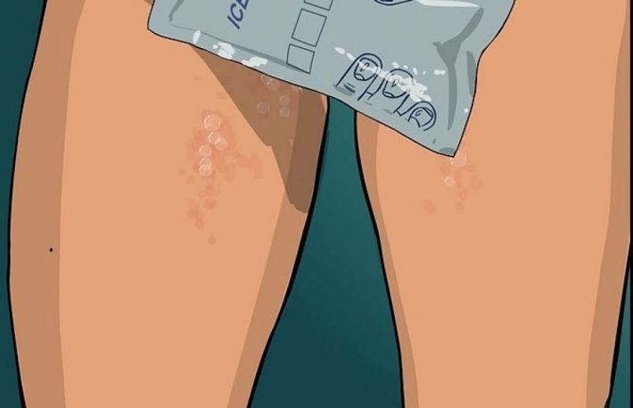 Cum sa depistezi herpesul