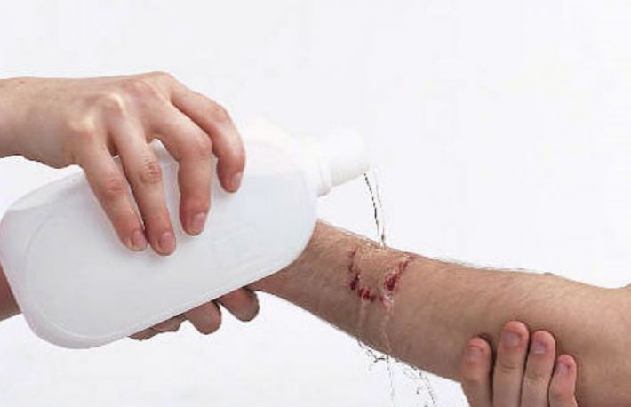  Cum se curata taieturile