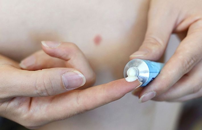 Remedii pentru tratarea muscaturilor de plosnite