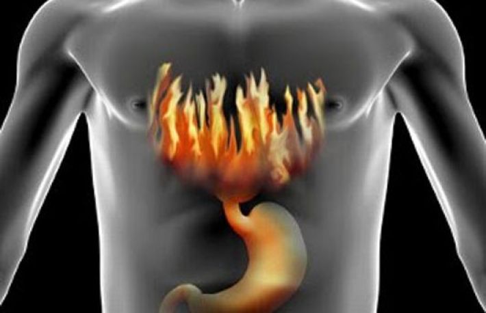 Remedii naturiste impotriva refluxului gastroesofagian