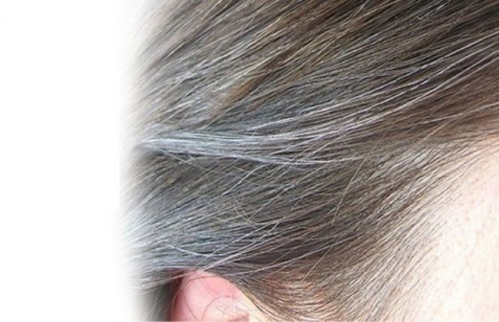 Parul grizonat poate ascunde boli grave