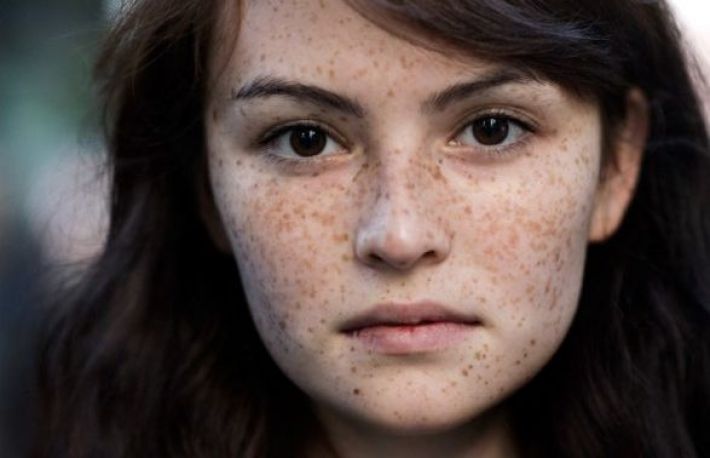 Ce spun pistruii despre sanatatea ta