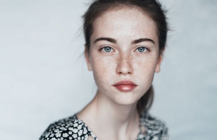 Cum sa scapi de pistrui. Foloseste aceasta formula naturala