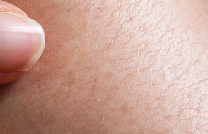 Ai pielea uscata? Iata cum poti s-o tratezi