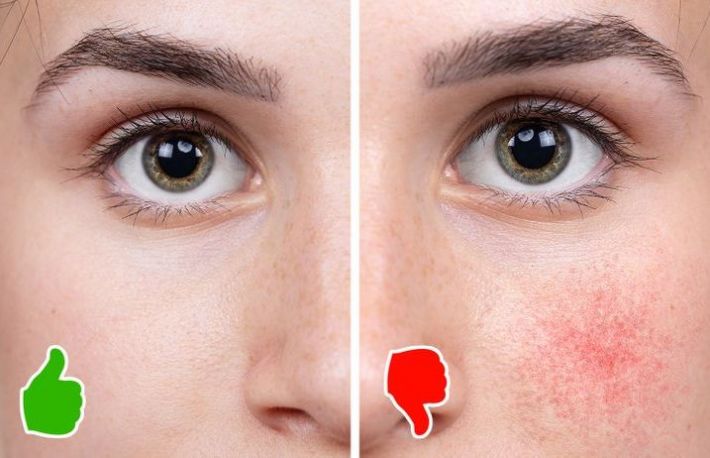 Ce se intampla cu pielea ta daca renunti la cafea