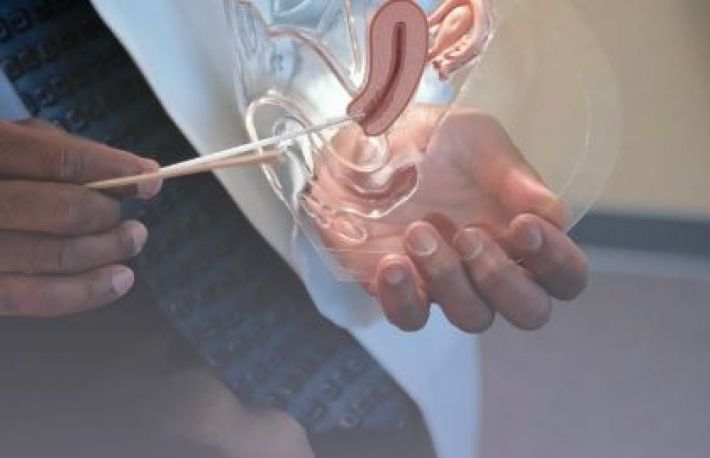 Cum sa tratezi prolapsul vaginal