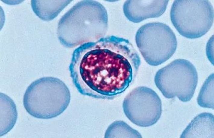 Cum sa cresti numarul de limfocite