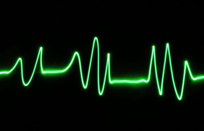 Cum sa va luati pulsul prin intermediul arterelor femurala, carotida si radiala