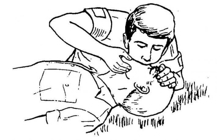 Cum se face respiratie gura la gura